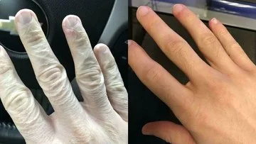 Transformasi Mengejutkan: Foto Before-After Ini Bikin Melongo