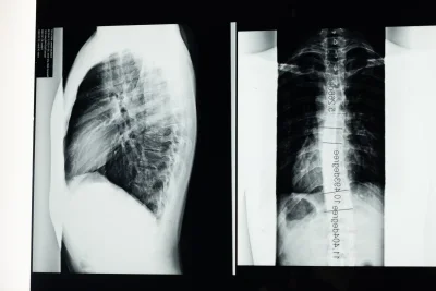 Foto-foto Medis Ini Bikin Merinding, Ada Fenomena Tubuh Tak Masuk Akal