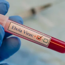 Thailand Terapkan Karantina 21 Hari untuk Cegah Ebola